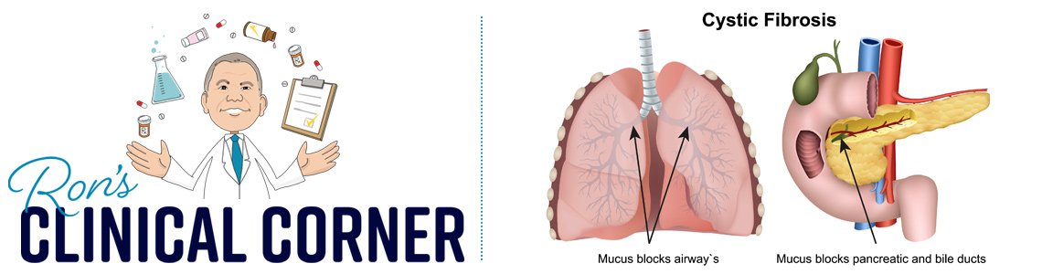 New Advances in the Treatment of Cystic Fibrosis hero image